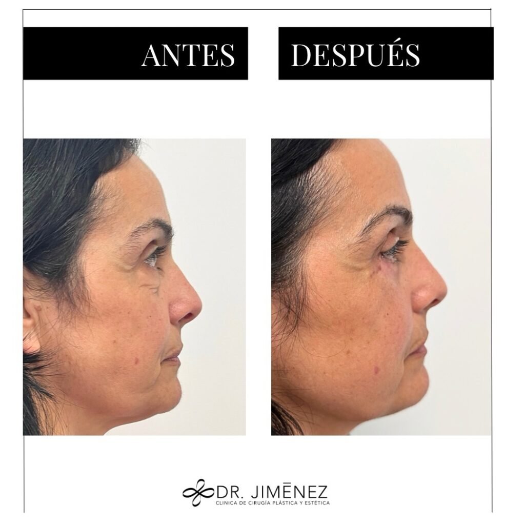 Instagram post from clinicadr.jimenez. This post is in position 3.