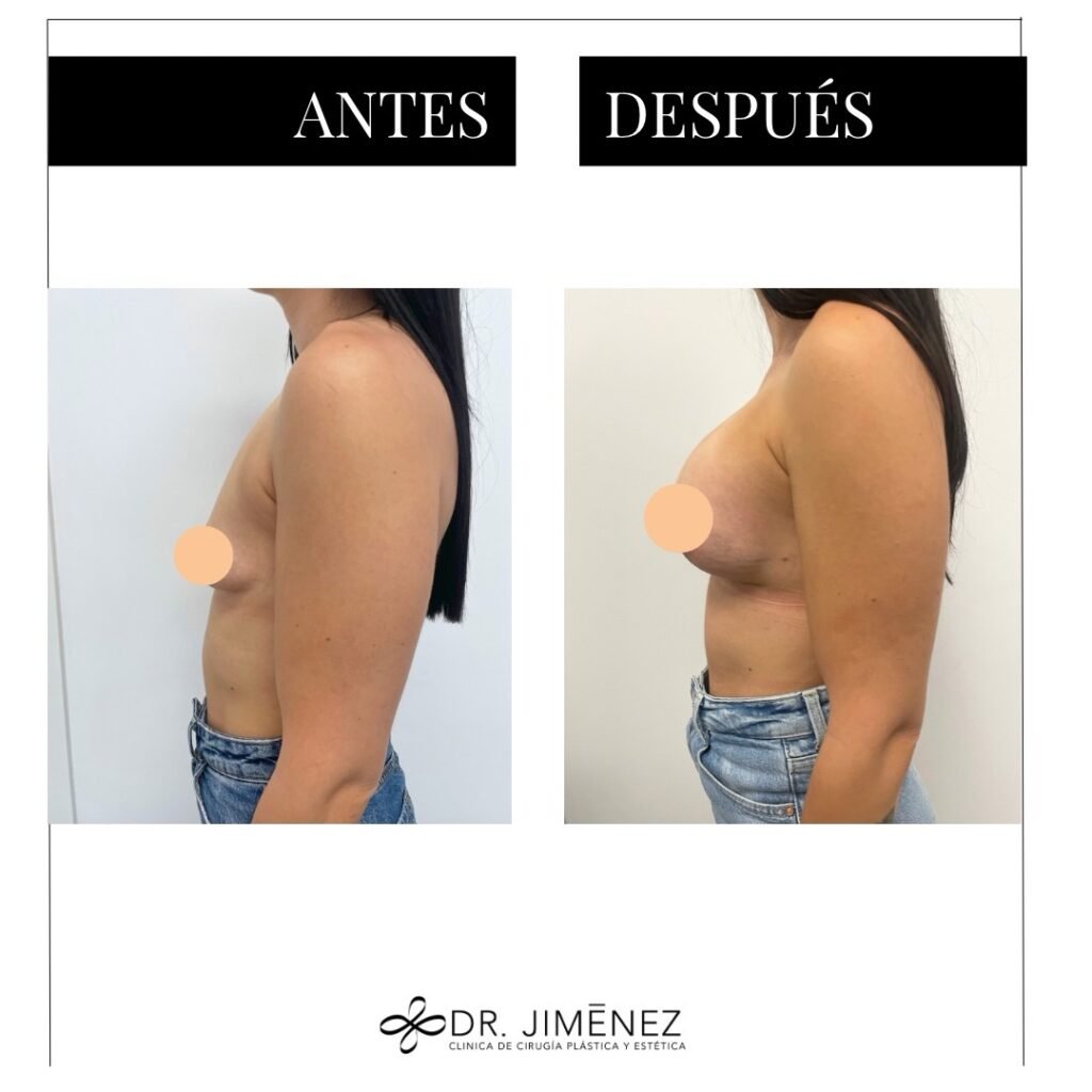 Instagram post from clinicadr.jimenez. This post is in position 4.