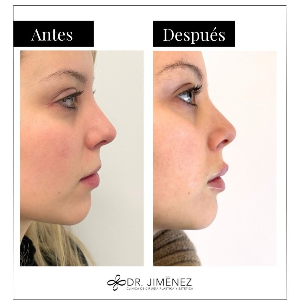 Instagram post from clinicadr.jimenez. This post is in position 1.