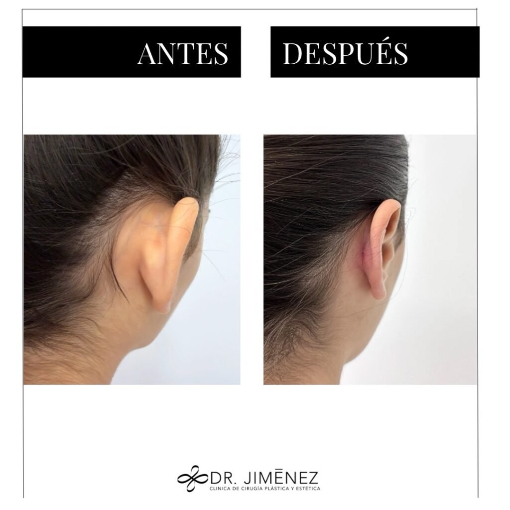 Instagram post from clinicadr.jimenez. This post is in position 2.