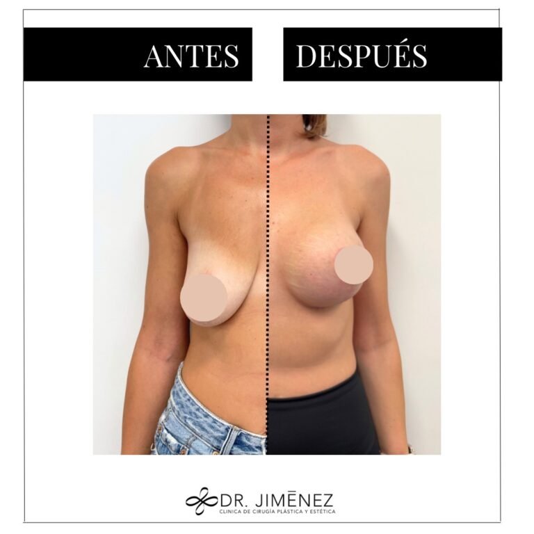 Instagram post from clinicadr.jimenez. This post is in position 2.