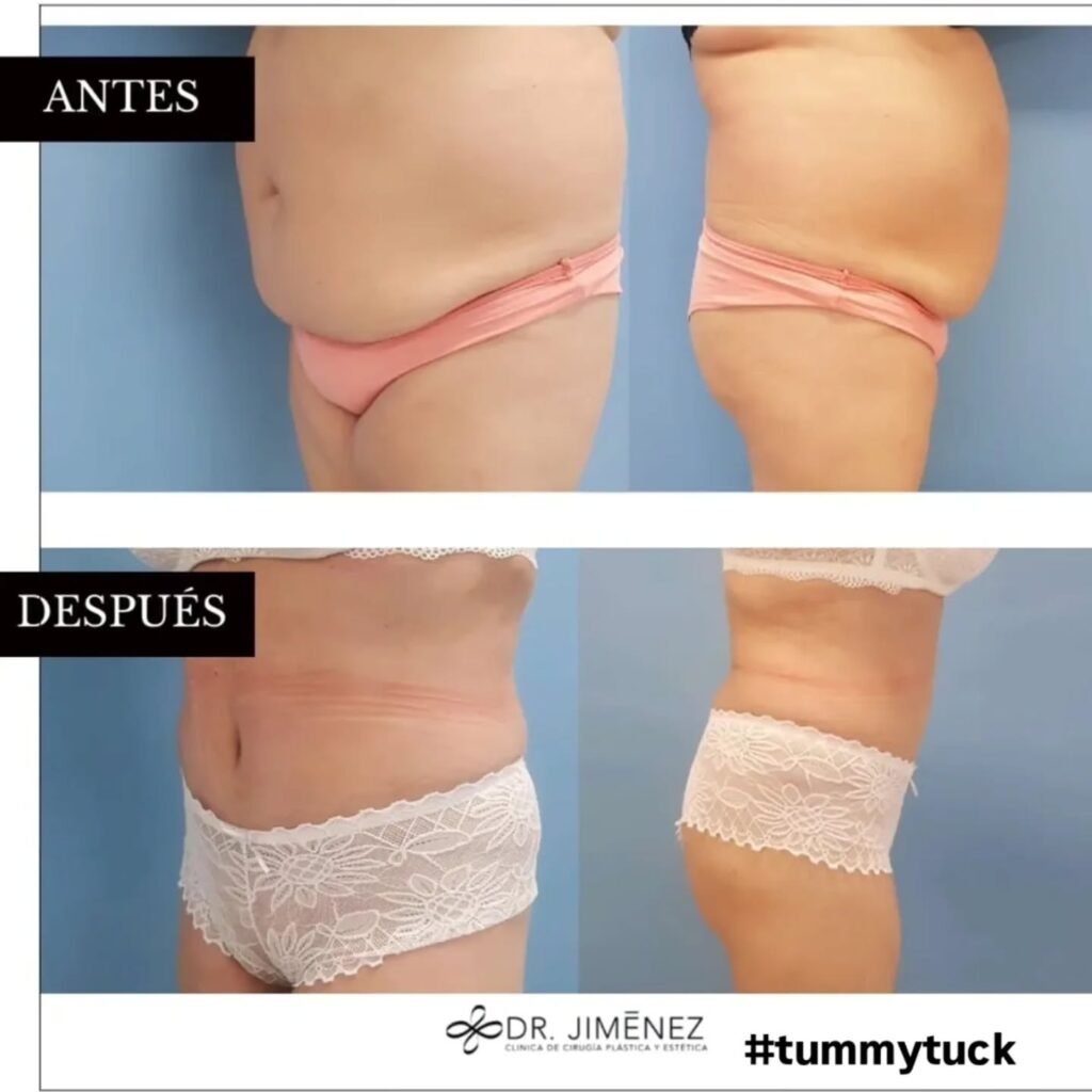 Instagram post from clinicadr.jimenez. This post is in position 0.