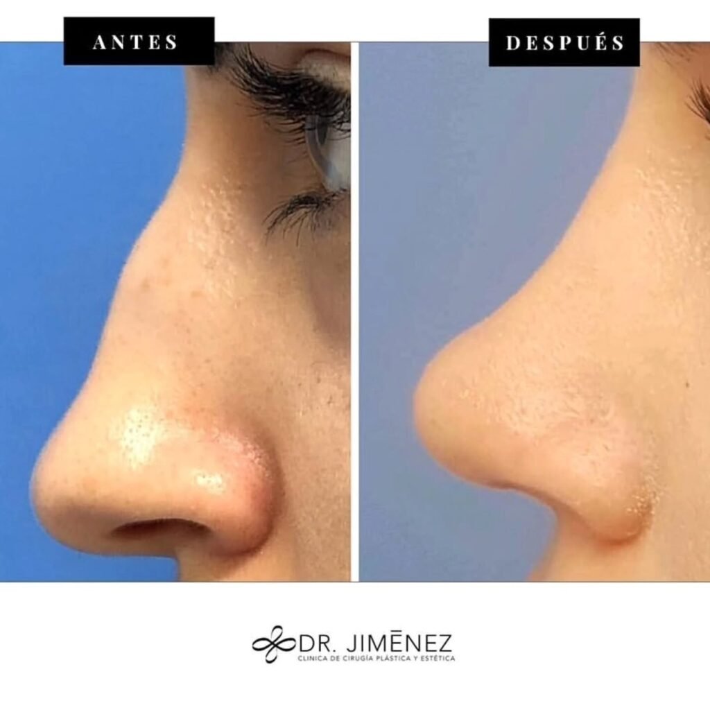 Instagram post from clinicadr.jimenez. This post is in position 0.