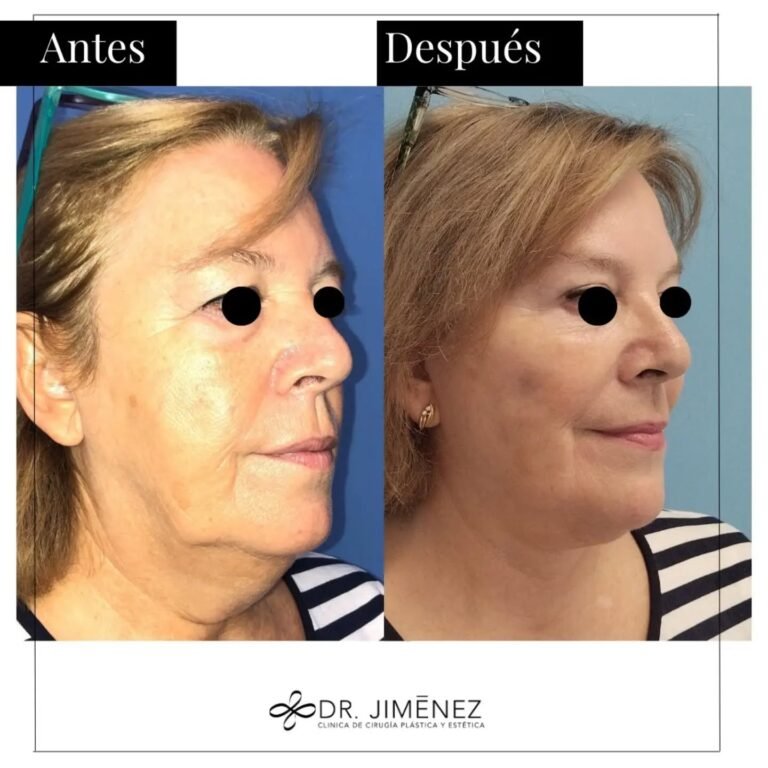 Instagram post from clinicadr.jimenez. This post is in position 1.