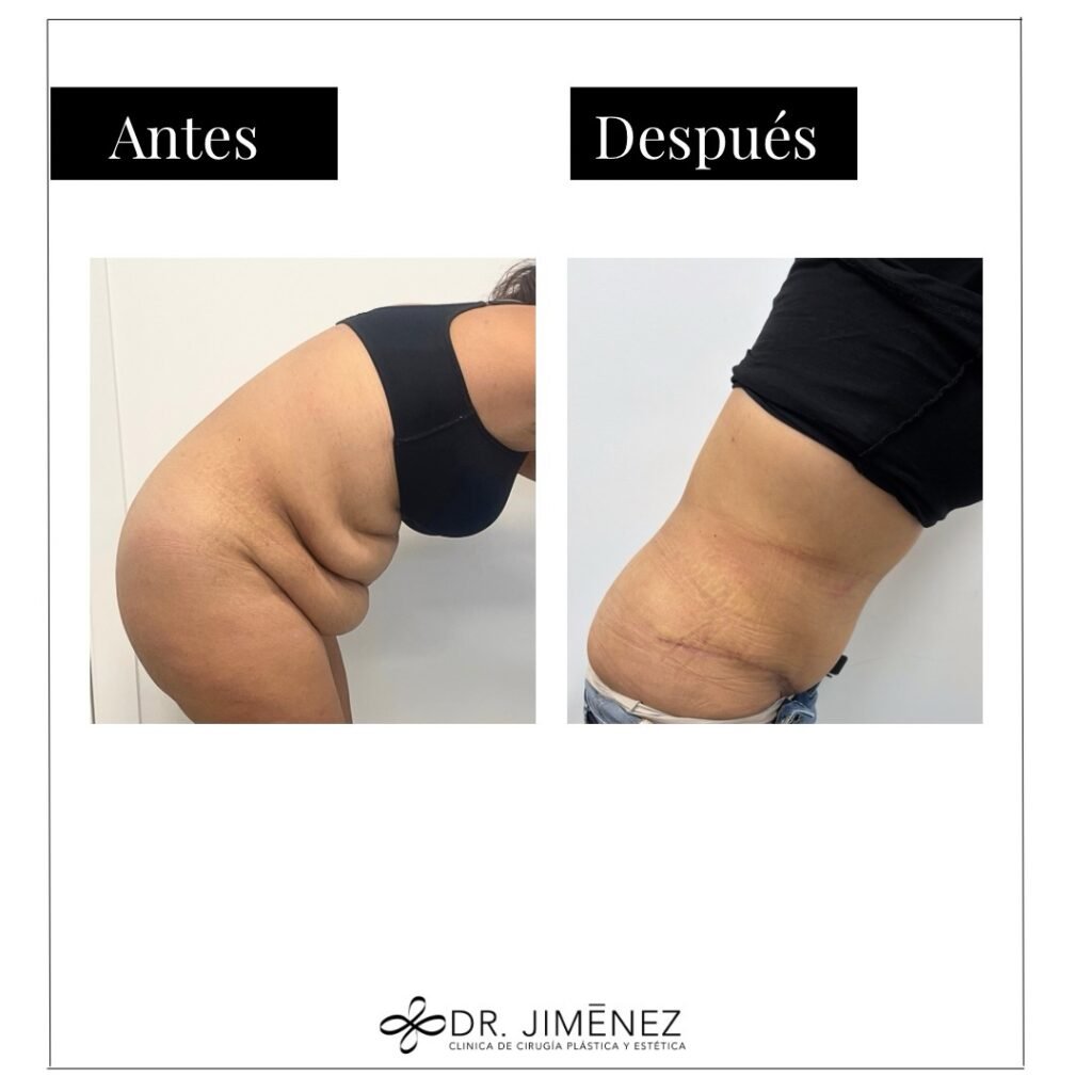 Instagram post from clinicadr.jimenez. This post is in position 1.