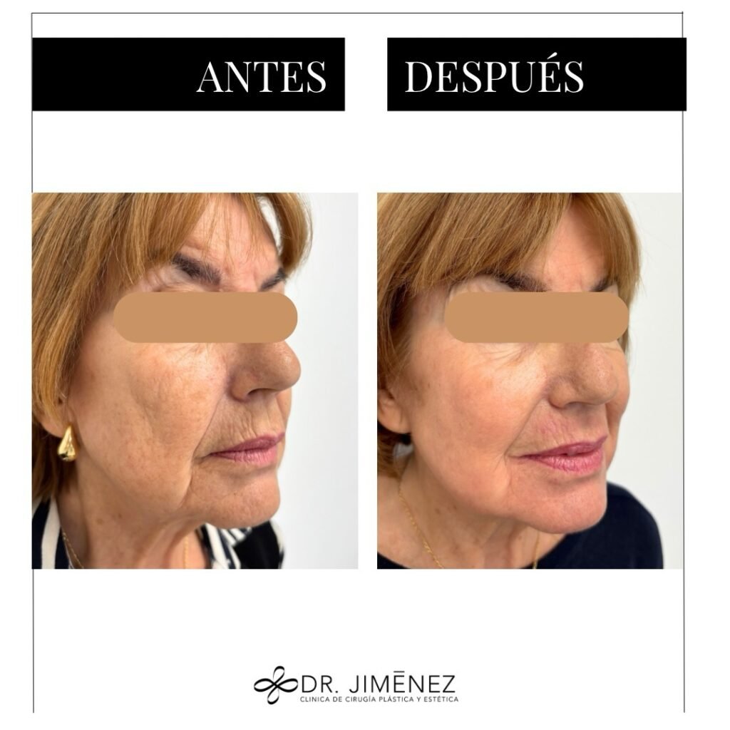 Instagram post from clinicadr.jimenez. This post is in position 1.