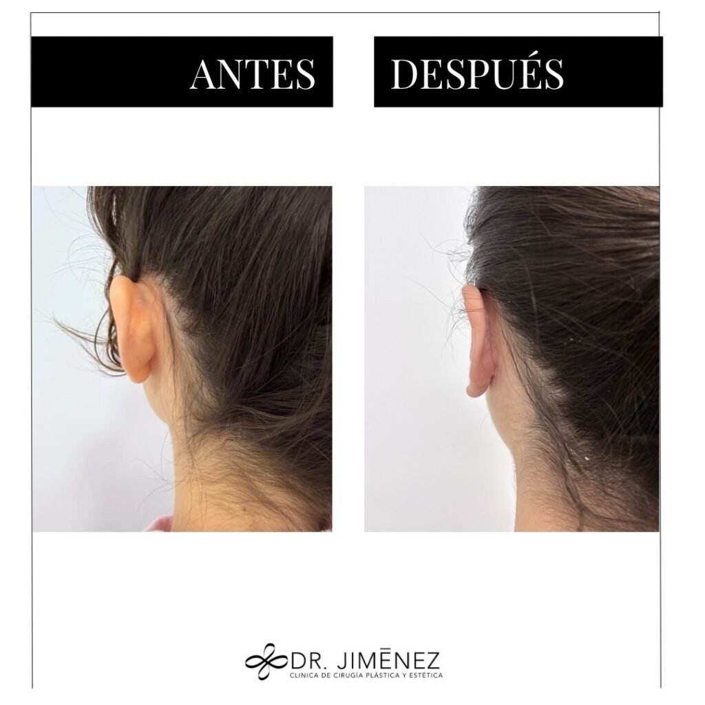 Instagram post from clinicadr.jimenez. This post is in position 1.