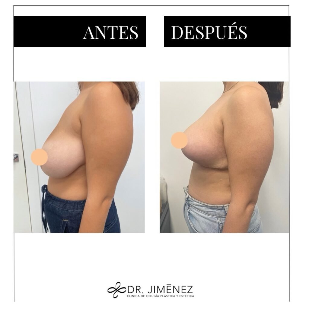 Instagram post from clinicadr.jimenez. This post is in position 4.