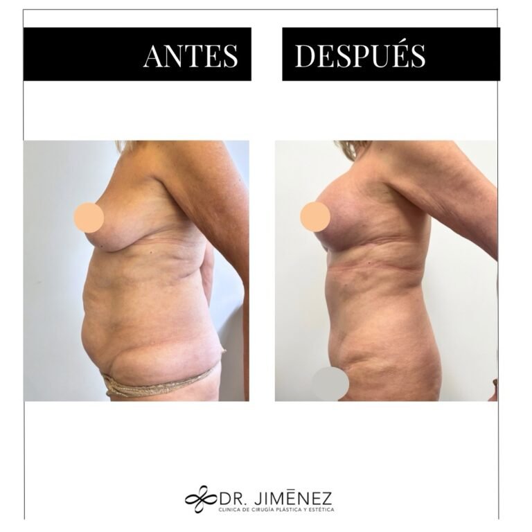 Instagram post from clinicadr.jimenez. This post is in position 1.