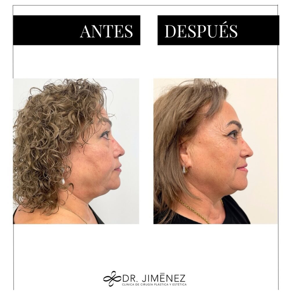 Instagram post from clinicadr.jimenez. This post is in position 2.