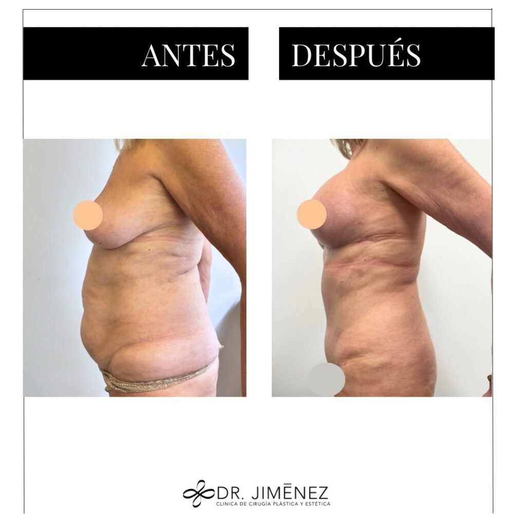 Instagram post from clinicadr.jimenez. This post is in position 0.