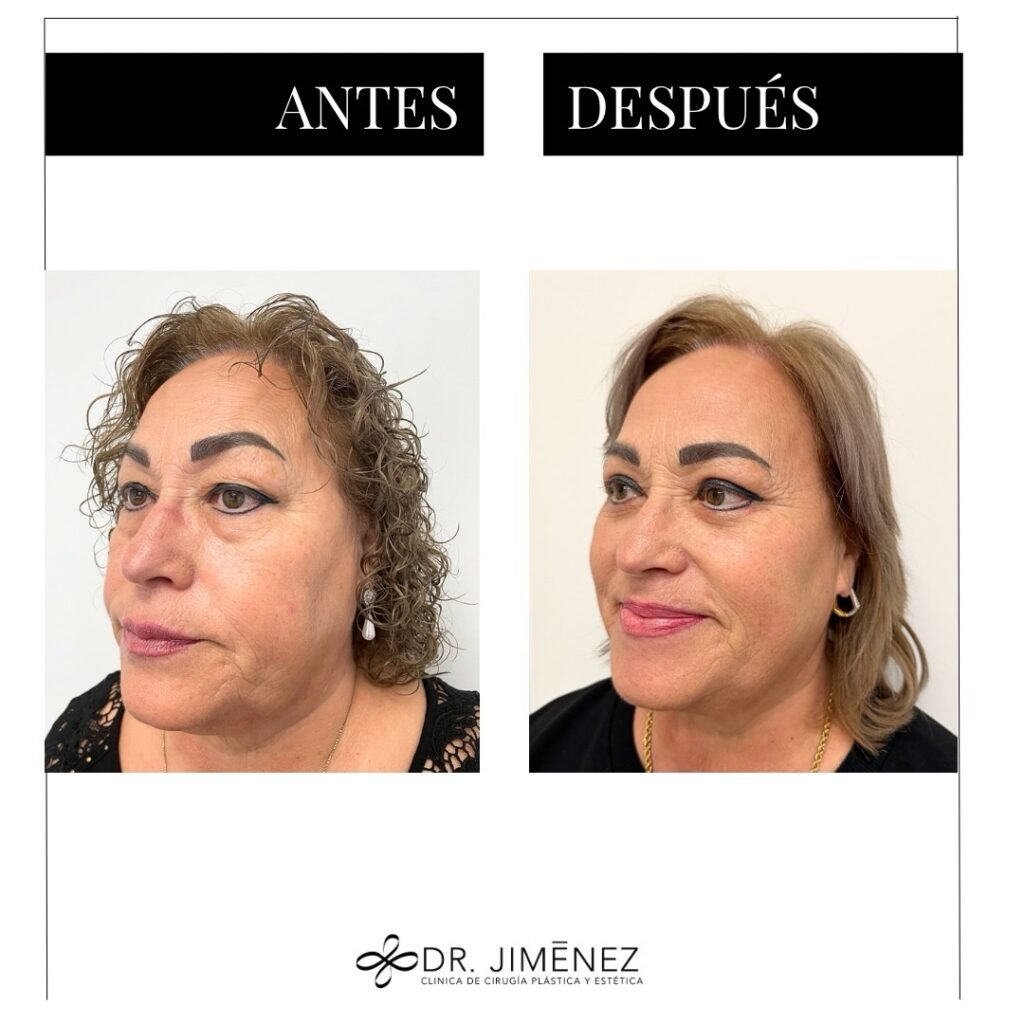 Instagram post from clinicadr.jimenez. This post is in position 1.