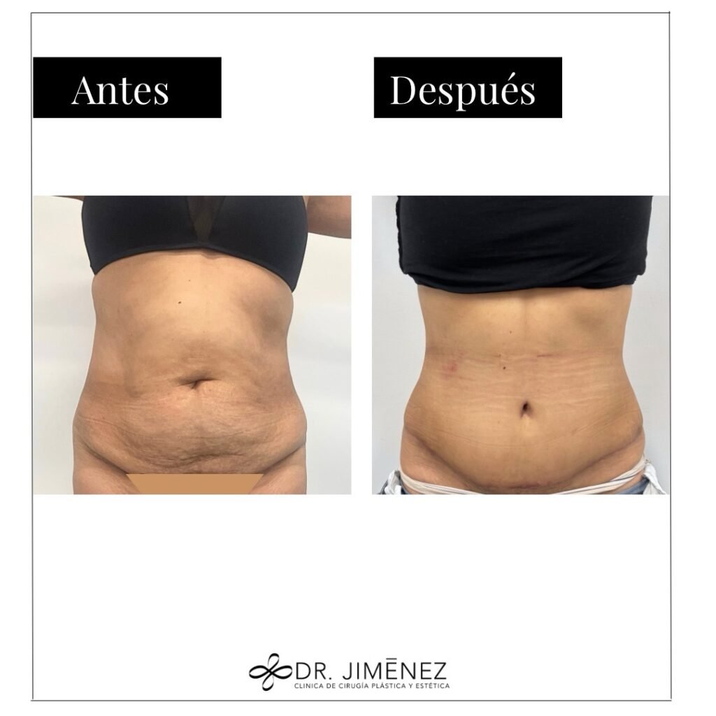 Instagram post from clinicadr.jimenez. This post is in position 0.