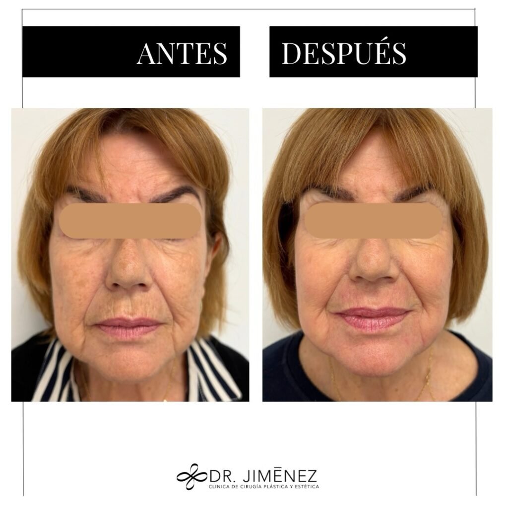 Instagram post from clinicadr.jimenez. This post is in position 0.