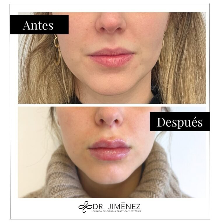 Instagram post from clinicadr.jimenez. This post is in position 4.