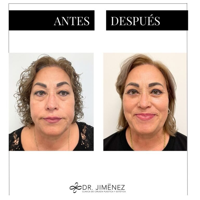 Instagram post from clinicadr.jimenez. This post is in position 1.