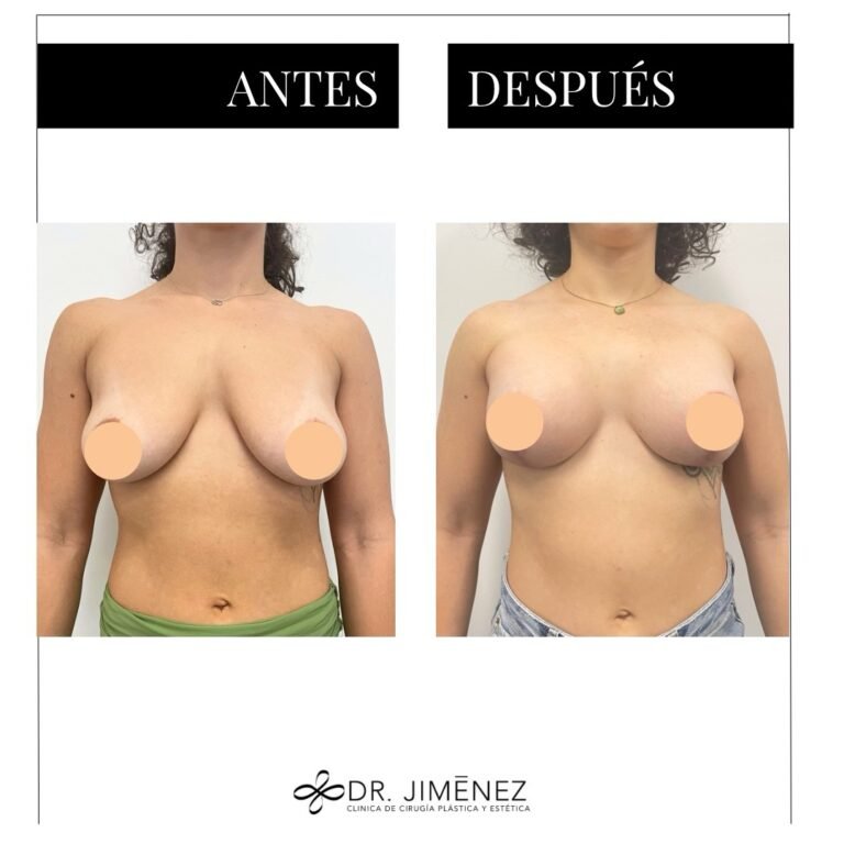 Instagram post from clinicadr.jimenez. This post is in position 1.