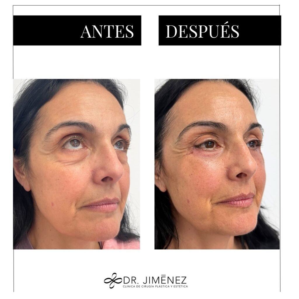 Instagram post from clinicadr.jimenez. This post is in position 1.
