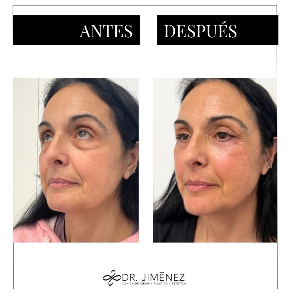 Instagram post from clinicadr.jimenez. This post is in position 2.