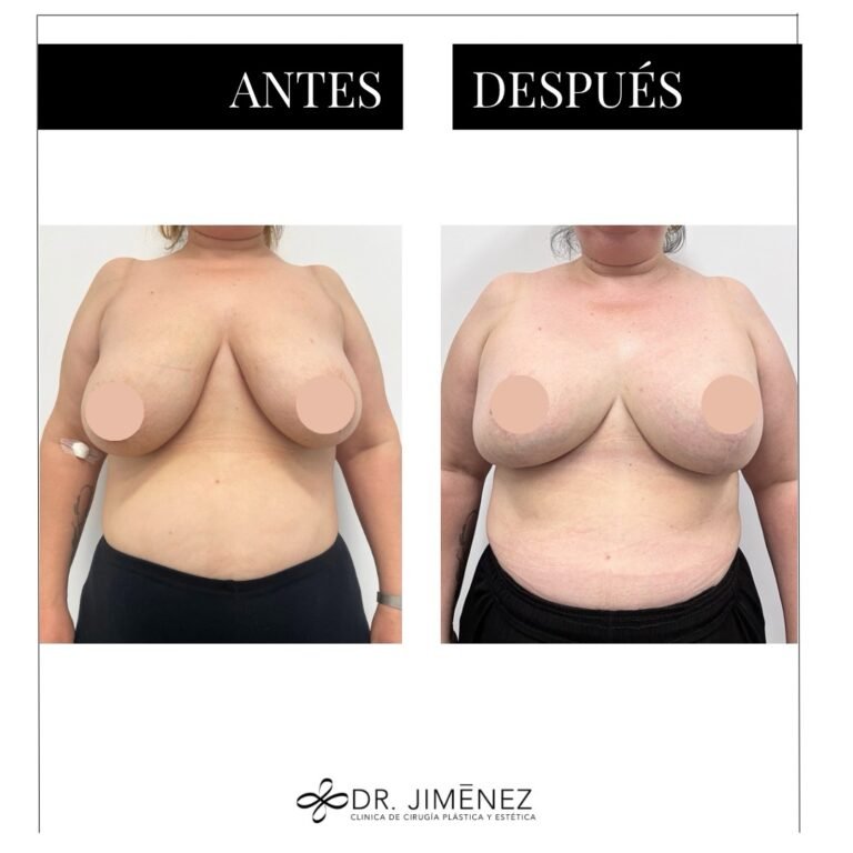 Instagram post from clinicadr.jimenez. This post is in position 1.