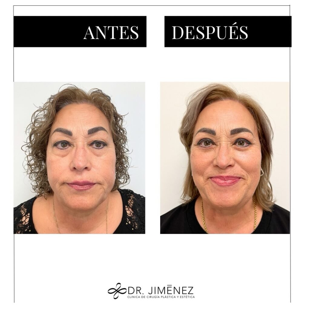 Instagram post from clinicadr.jimenez. This post is in position 0.