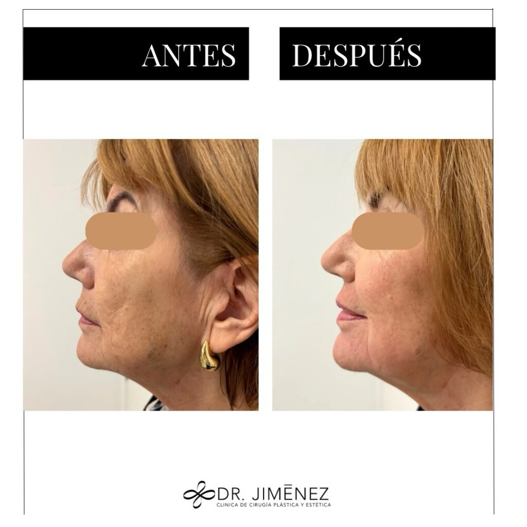 Instagram post from clinicadr.jimenez. This post is in position 2.