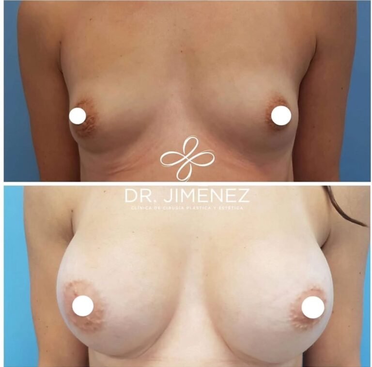 Instagram post from clinicadr.jimenez. This post is in position 1.