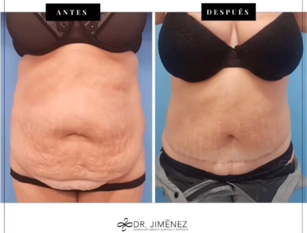 Instagram post from clinicadr.jimenez. This post is in position 0.