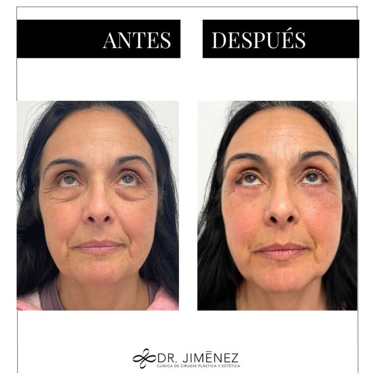 Instagram post from clinicadr.jimenez. This post is in position 1.