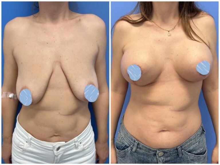 Instagram post from clinicadr.jimenez. This post is in position 1.